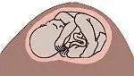 Simulaids Obstetrical Manikin