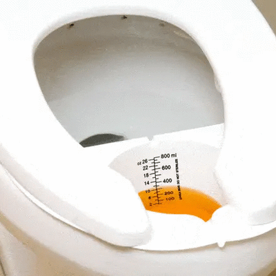 Urine & Stool Specimen Collection Pan, Nurses Hat