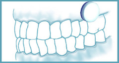 XyliMelts Stick-On Melts for Dry Mouth Moisturizing 40 Count